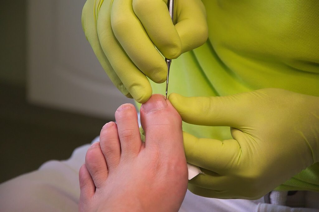 foot care, podiatry, treatment